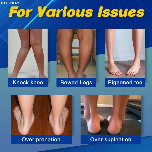 Cithway™ Orthopedic Leg-Correcting Magnetic Therapy Shoe Insoles