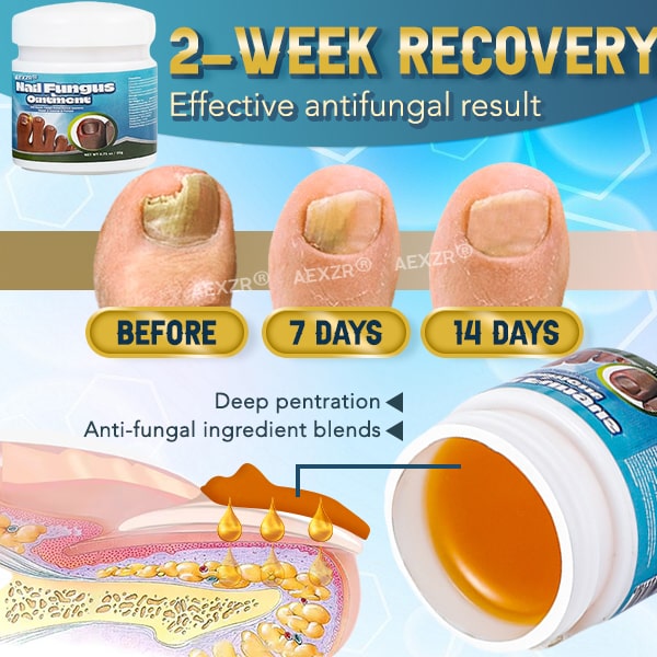✨Aexzr® 5X Quick-healing Nail Fungus Ointment
