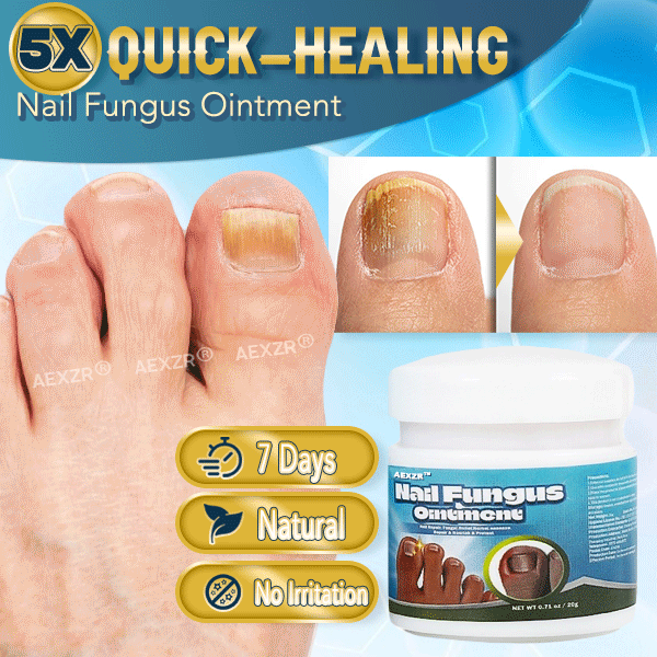 ✨Aexzr® 5X Quick-healing Nail Fungus Ointment